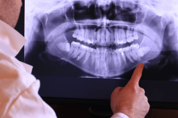 Best Emergency Treatment for Toothache in Melville, RI
